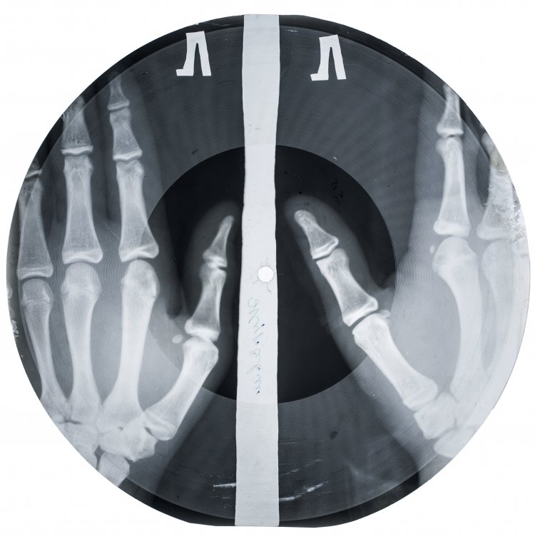 Auf dem Bild ist eine R&ouml;ntgenschallplatte zu sehen, auf der die R&ouml;ntgenaufnahme von zwei flachen H&auml;nden erkennbar ist. | © X-Ray Audio Project